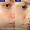 Dermi Ve Oil Free Moisturizer | Best Moisturizer For Skin Care | Best Quality Skin Moisturizer