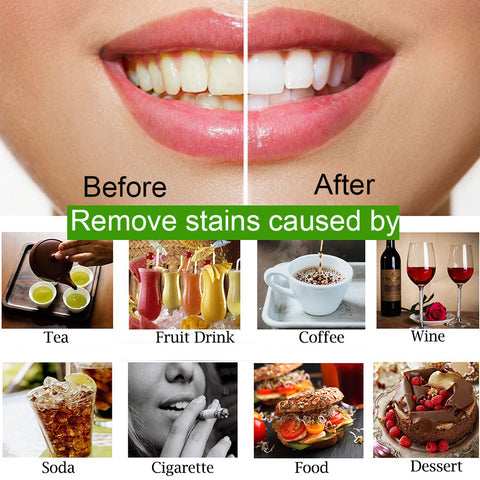 Teeth Whitening Charcoal Powder (organic) Charcoal