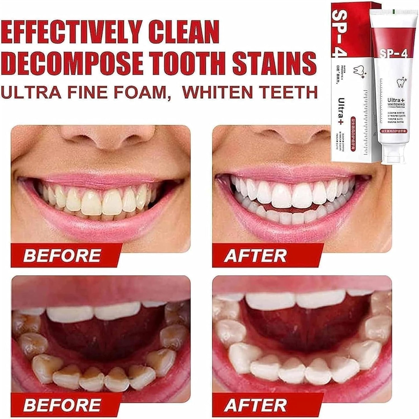 Yayashi Sp-4 Ultra Whitening Toothpaste Probiotic Stain Remover