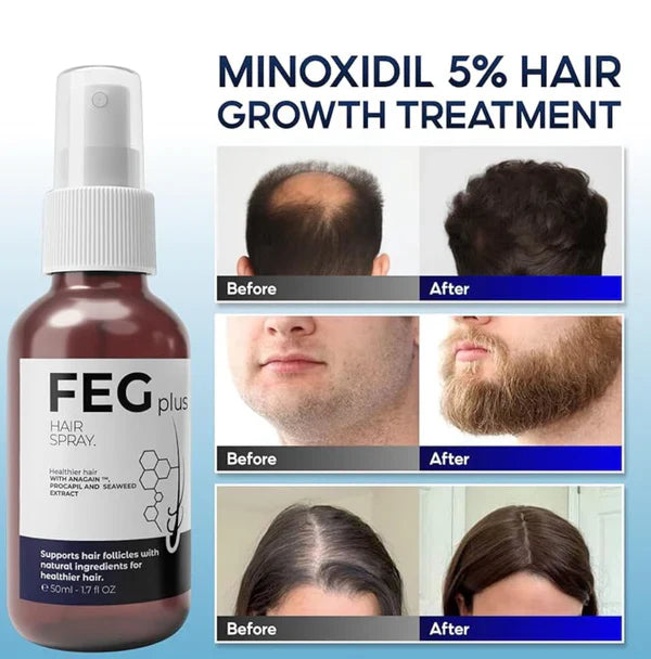 FEG Plus Hair Growth Spray – Stimulate Follicles, Reduce Hair Fall And Healthier Growth